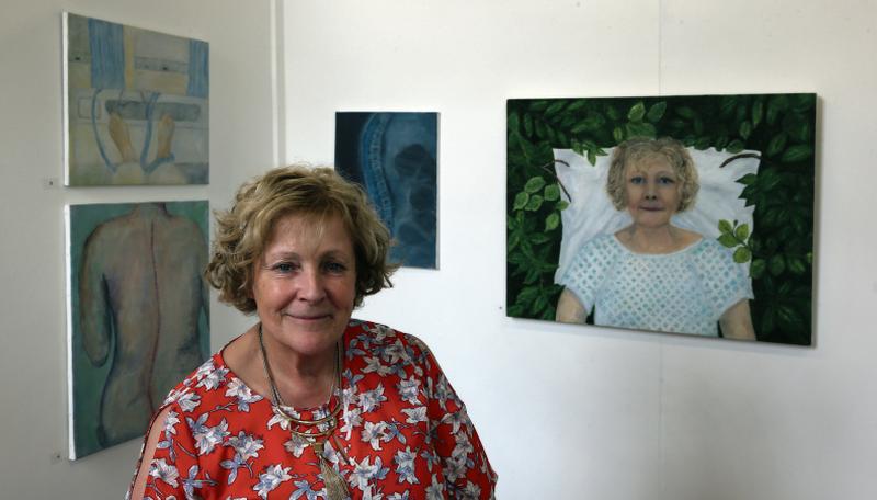Marie Cunningham with some of her work at the GMIT BA Fine Art Level 7 Graduate Degree Show at Cluain Mhuire. Marie's exhibition represents her journey with her medical treatment for scoliosis.